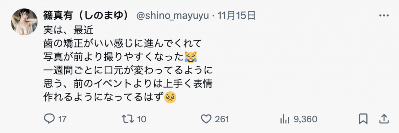 矫正牙齿中!史上最强隐藏巨乳、最细JCup的她要变性感女神?