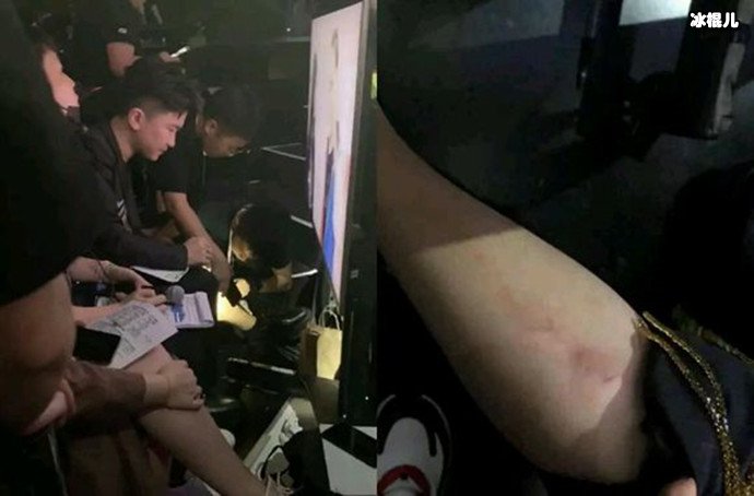 为何张大大在明日之子摔伤?张大大被很多人讨厌吗?