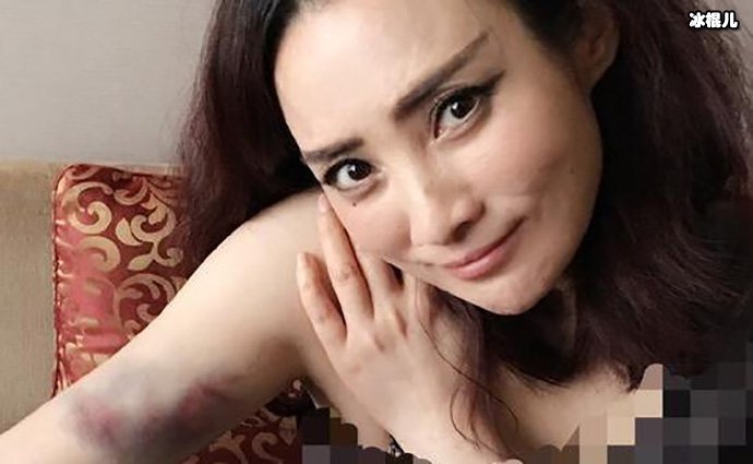 蒋勤勤拍戏受伤被网友说是一位敬业的明星!其本人如何回应!