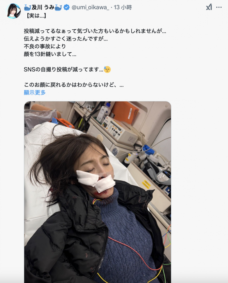 社群发文变少⋯原来及川うみ(及川海)出大事了!